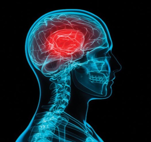 Managing Sport-Related Concussions in Children and Adolescents (2026-05-01 - 2026-08-01)