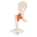 Modèle - Articulation fonctionnel de la hanche, Deluxe