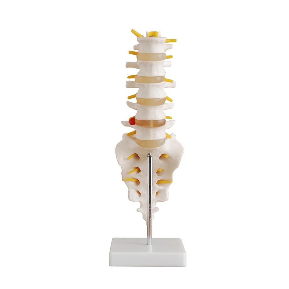 Anatomical model - Lumbar spine with open sacrum