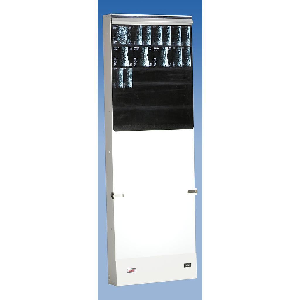 Single Trimline Spinal X-ray viewer - 35 cm (14") x 91 cm (36") - reg. $ 499.00 {↓}