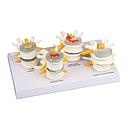 Anatomical model - Degeneration of the column on a base