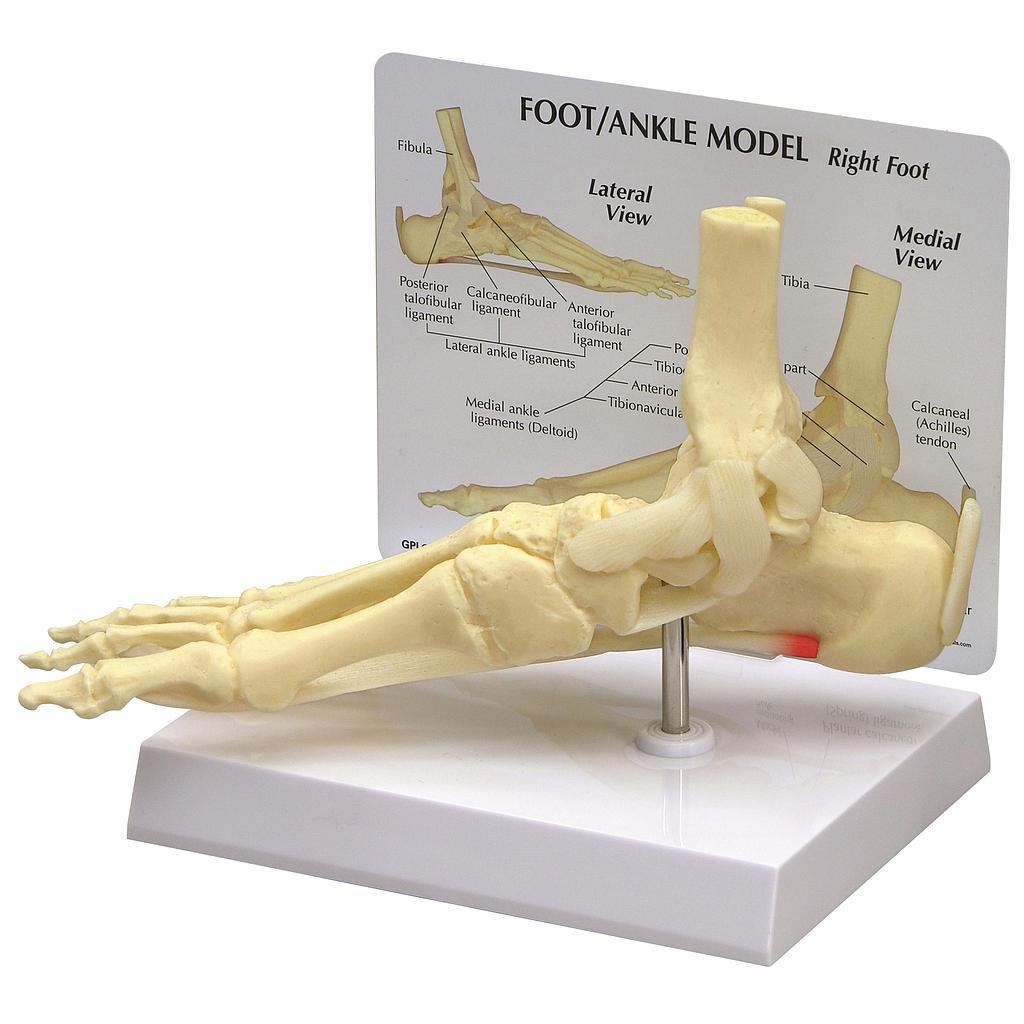 [117-269] Model - Foot with Plantar Fasciitis - Reg.: 210,00$